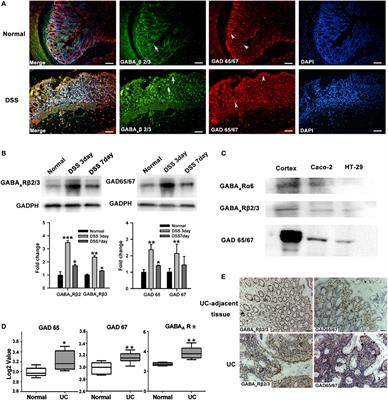 Activation of GABAA Receptors in Colon Epithelium Exacerbates Acute Colitis